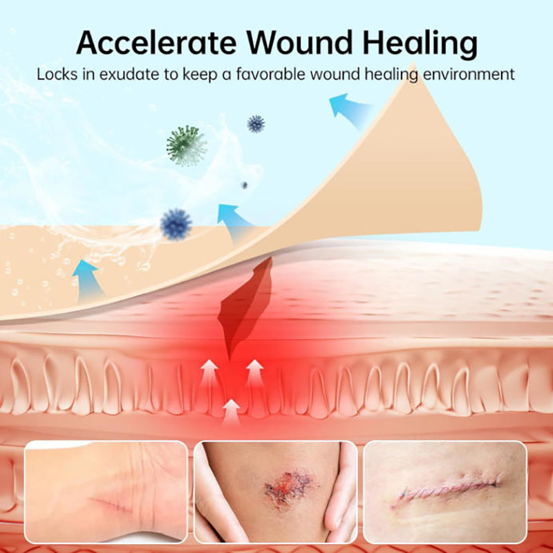 Beyond Oriva™ Hydrocolloid Roll for Wound Care – Self-Adhesive Absorbent Bandages