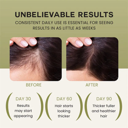 Beyond Oriva™ Batana Hair Oil for Nourishment and Moisturizing