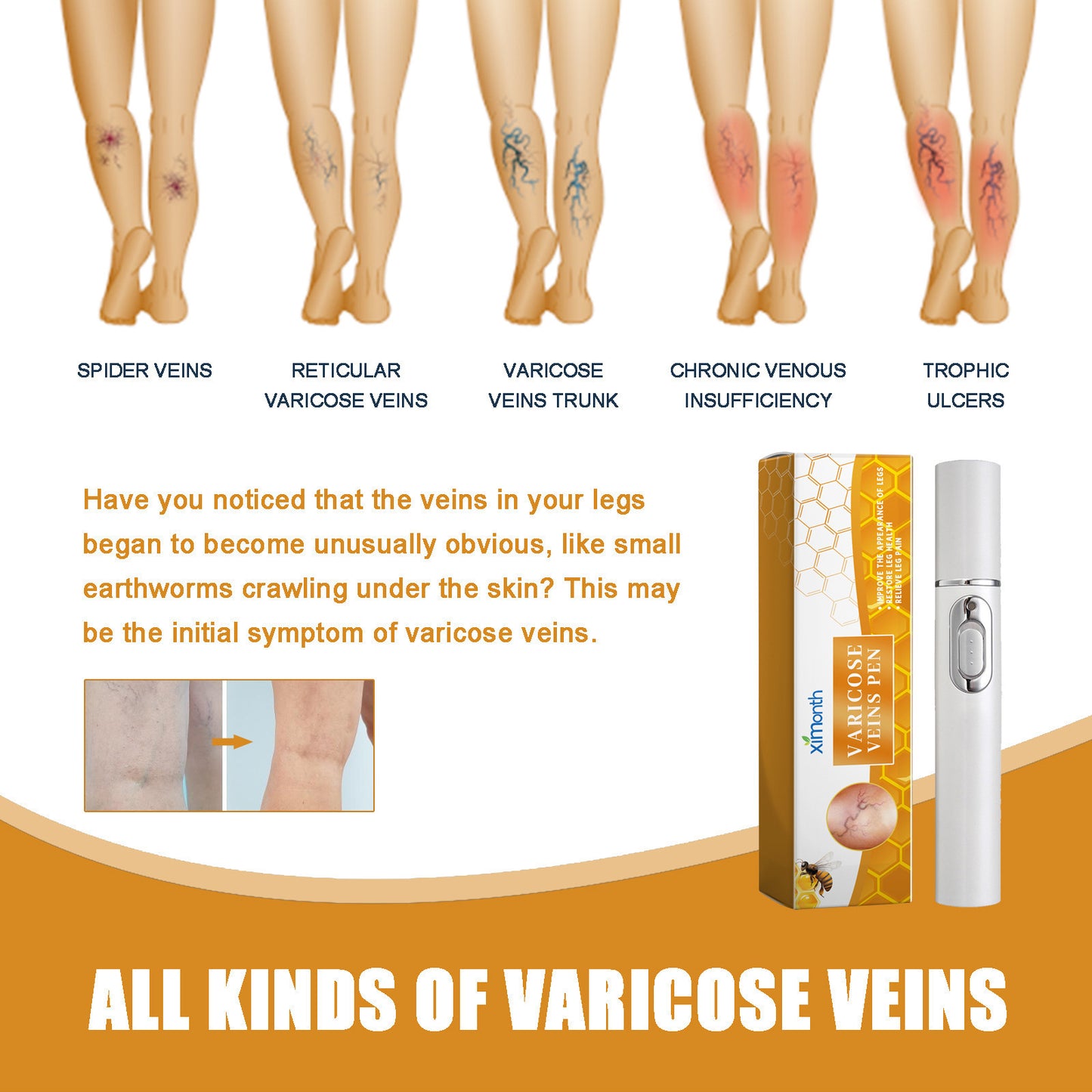 Beyond Oriva™ Leg massage care pen with herbal fragrance