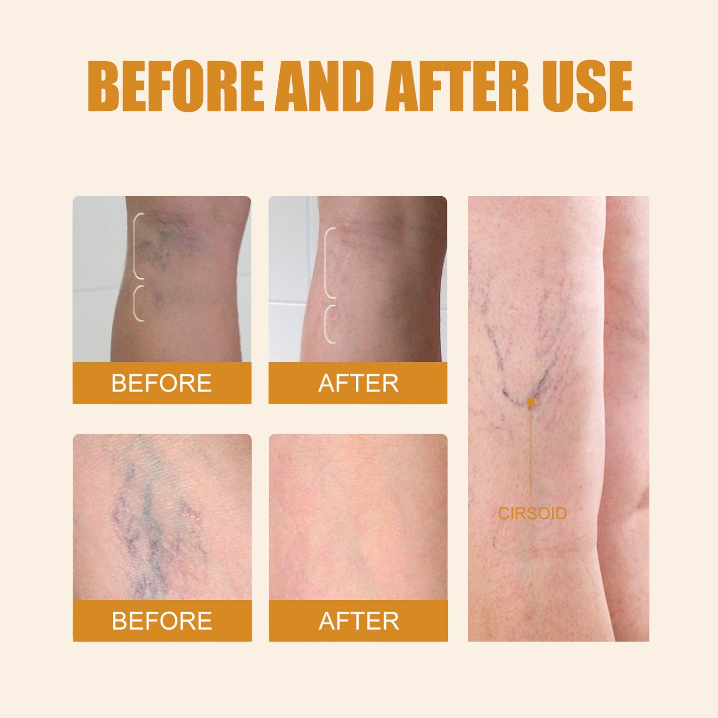 Beyond Oriva™ Leg massage care pen with herbal fragrance