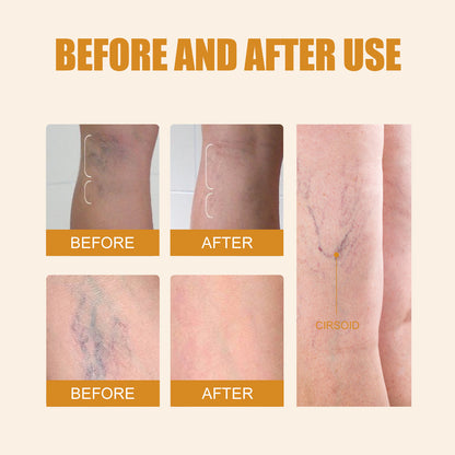 Beyond Oriva™ Leg massage care pen with herbal fragrance