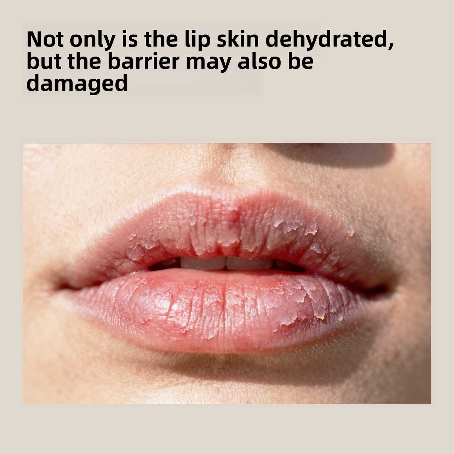 Beyond Oriva™ Children's Lip Balm