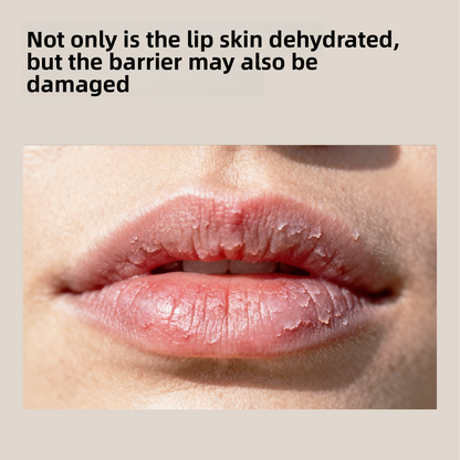 Beyond Oriva™ Children's Lip Balm